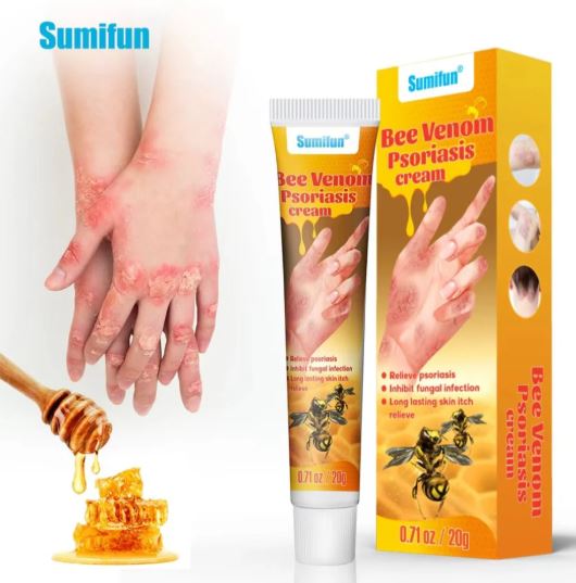 كريم سم النحل من Ummifun لتخفيف الصدفية وإصلاح البشرة وترطيبها